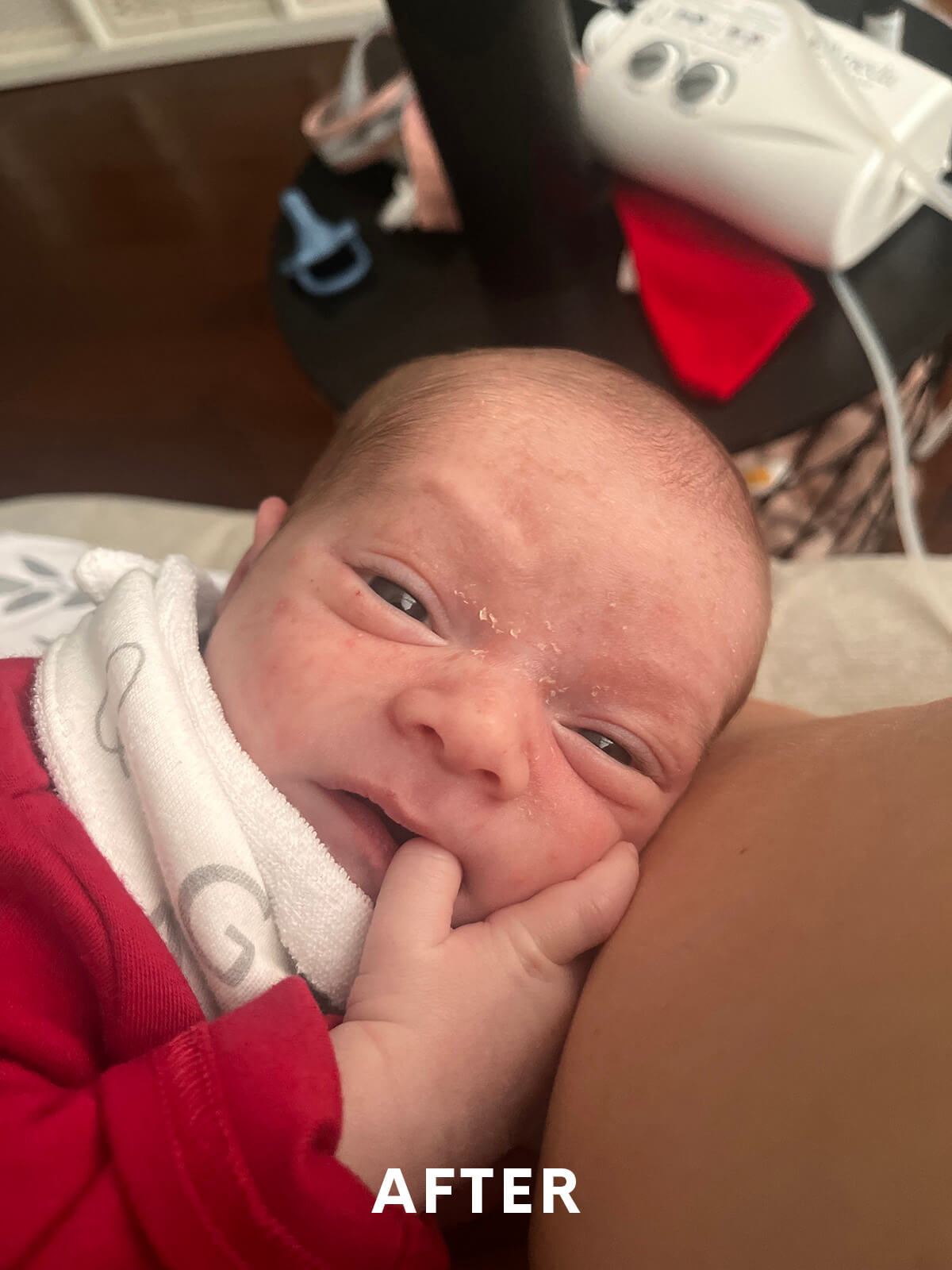 Infant Skincare After