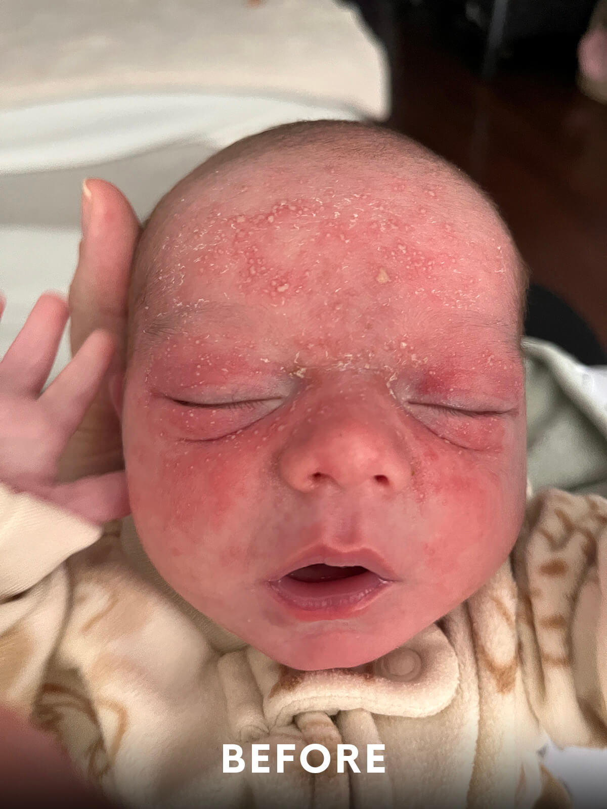 Infant Skincare Before