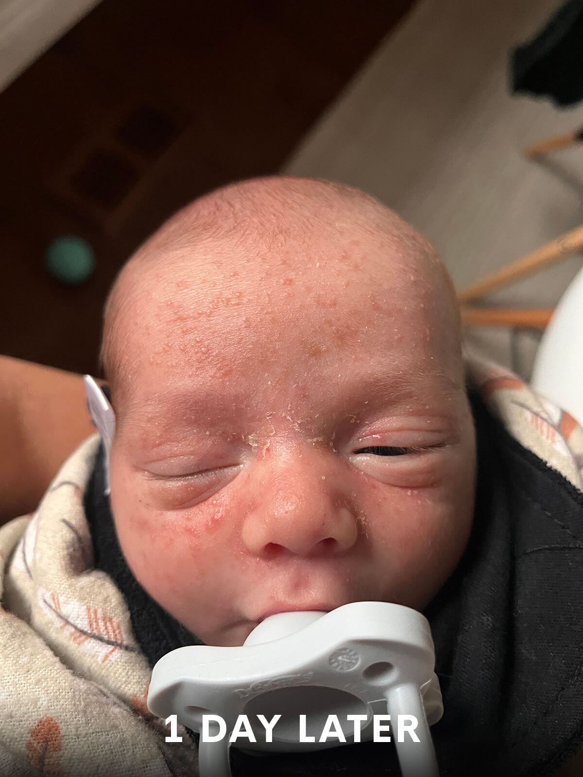 Infant Skincare