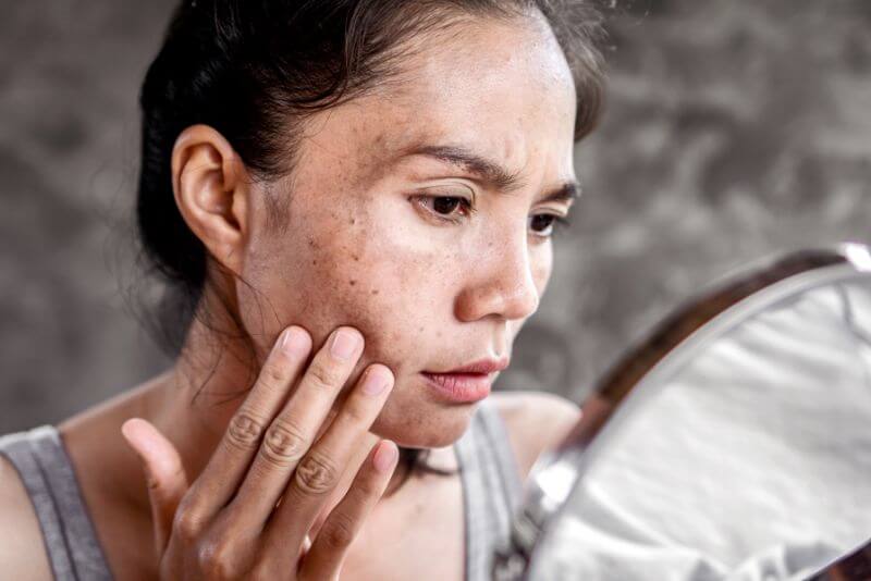 skin concern